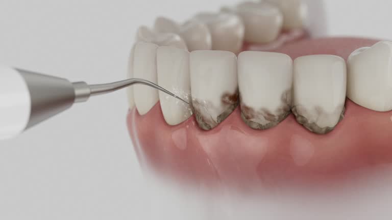 Trusted Dental Crowns And Bridges service in Port Monmouth, NJ - Dentist Open Now